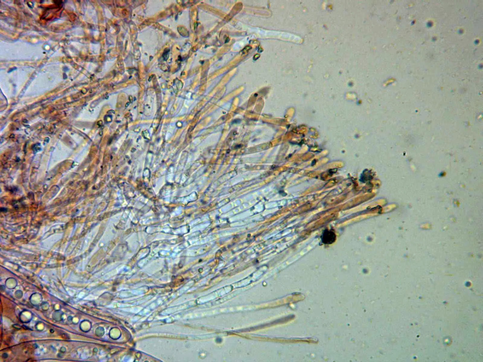 Microscopía de Sepultariella patavina - 13 - Pelos x 400